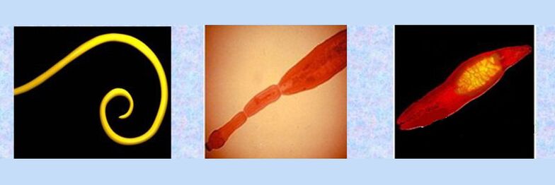 Виды паразитов в организме человека – круглые черви, ленточные черви, сосальщики. 